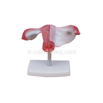 DOĞAL UTERUS MODELİ